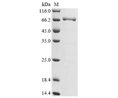 DT3C重组蛋白SDS-PAGE验证