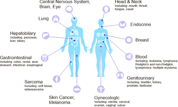 癌症在人体中的分布